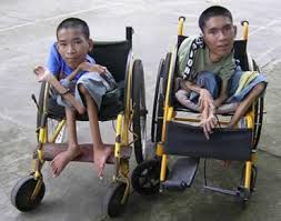 Agent Orange and the children of Hoi