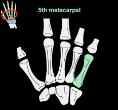 5th metacarpal