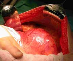 http://biomed.brown.edu/Courses/BI108/BI108_2007_Groups/group05/Images/aaa.jpg