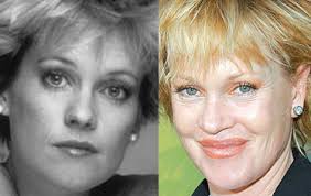 Image Melanie Griffith Plastic Picture