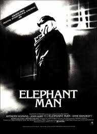 Image The <b>Elephant Man</b> Picture