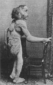 Image <b>Elephant man</b> Picture