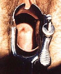 How to Examine Your Own Cervix