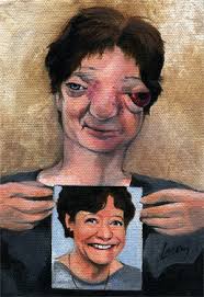 Chantal Sebire double portrait