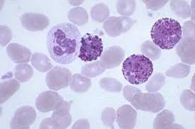 precursors identified in CML