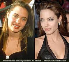 Stars Before and After Angelina