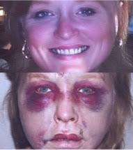 After Angela Garbarino was