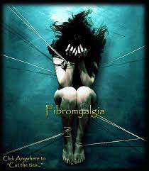 Fibromyalgia is