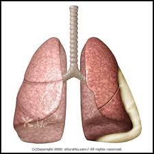 http://www.ecureme.com/atlas/data/dis_images/Pleurisy550_ab.jpg