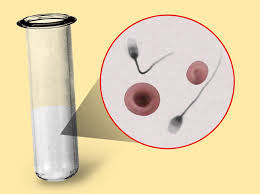 http://upload.wikimedia.org/wikipedia/commons/2/2e/Hematospermia.jpg