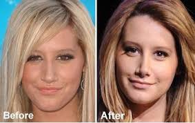 Well she went for a nose job,
