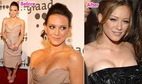 <b>hilary</b>-<b>duff</b>-breast-implants.jpg