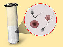 http://wpcontent.answers.com/wikipedia/commons/thumb/2/2e/Hematospermia.jpg/220px-Hematospermia.jpg