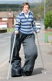 Proteus Syndrome (attributed to