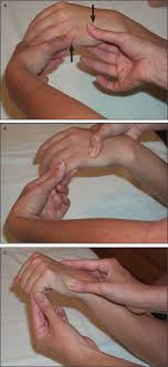 Reducing a fifth metacarpal bone