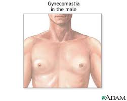 http://www.mdconsult.com/das/patient/body/0/0/10041/9359_en.jpg