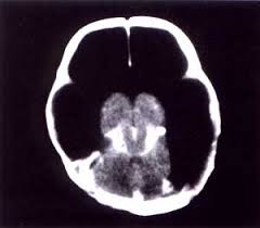 http://2.bp.blogspot.com/_xafwM2n0nmw/SCznVH6DNtI/AAAAAAAAAGo/wJ5JlGcyhPA/s400/imagen6.jpg