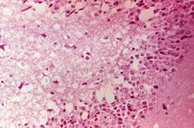 http://upload.wikimedia.org/wikipedia/commons/d/d7/Venezuelan_equine_encephalitis_virus.jpg