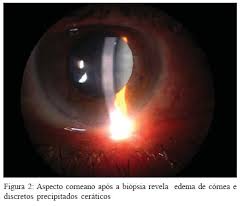 http://www.scielo.br/img/revistas/rbof/v67n3/a07f02.jpg