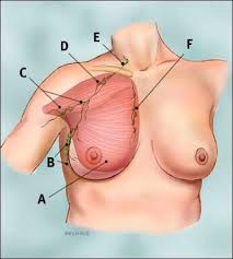 Lymphatic Drainage