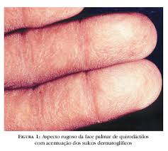 http://www.scielo.br/img/revistas/abd/v82n6/a14fig01.jpg