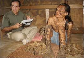 pictures of skin conditions