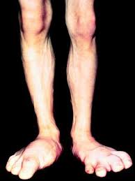 http://www.faqs.org/health/images/uchr_01_img0062.jpg