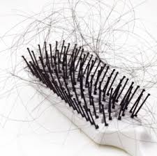 Female hair loss comes from a