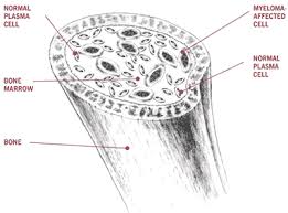 Picture of the bone