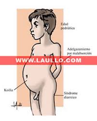 http://www.laullo.com/medicina/ilustracion_medica/pediatria/images/enfermedad_celiaca_jpg_jpg.jpg